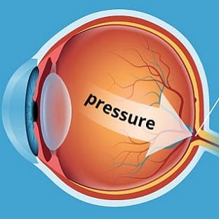 Glaucoma Services