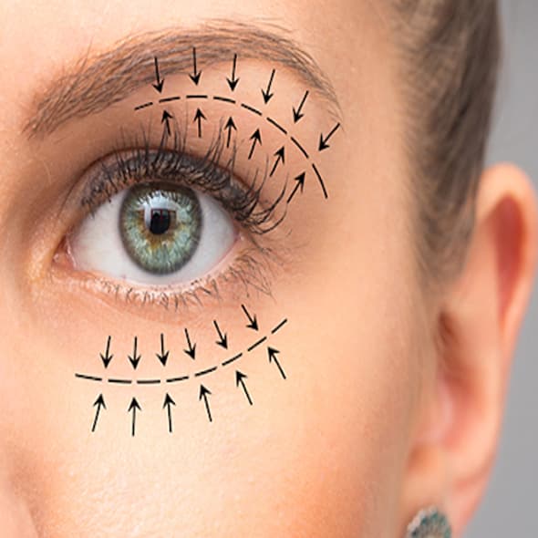 Oculoplasty Services