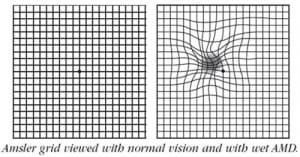 Amsler grid